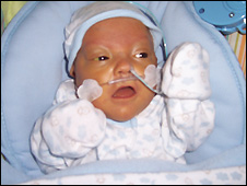 Infant baby Infant baby