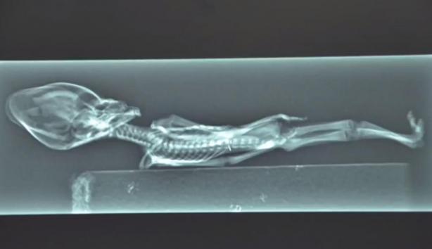 Tiny-alien-skeleton-contains-human-DNA1